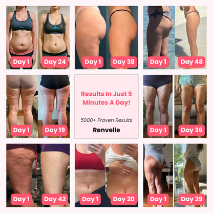 Renvelle - Cellulite Sculpt System